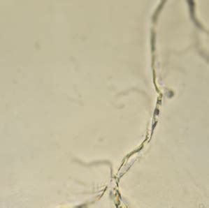 mucus threads in tagalog|mucous in Tagalog .